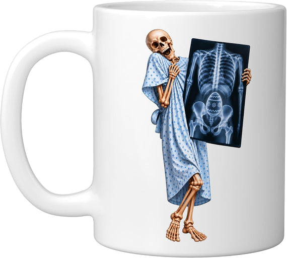 Easter Egg Radiology Novelty Gag Humor Ceramic Mug