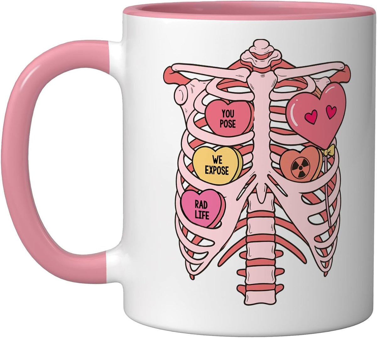 Valentine’S Day Rad Tech Radiology X-Ray You Pose We Ceramic Mug