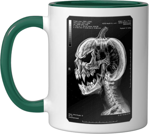 Radiology Nurse Radiologist Halloween Pumpkin Skull X Ray Ceramic Mug